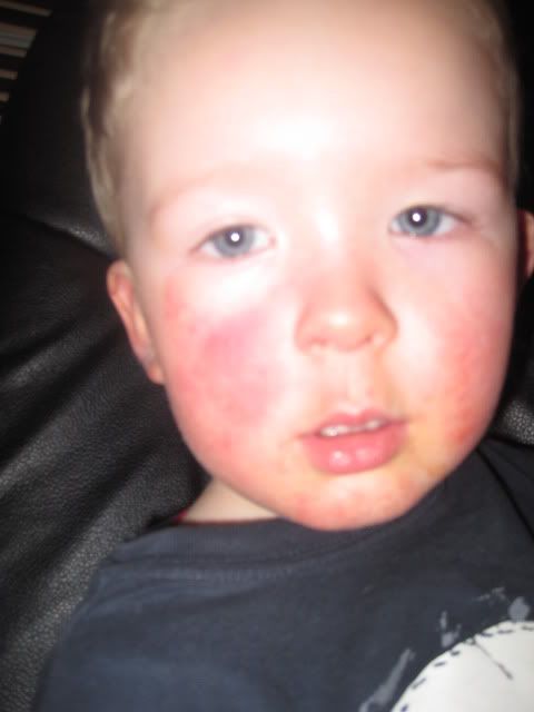 3 1/2 Old with Red Cheeks - Mamapedia&trade;